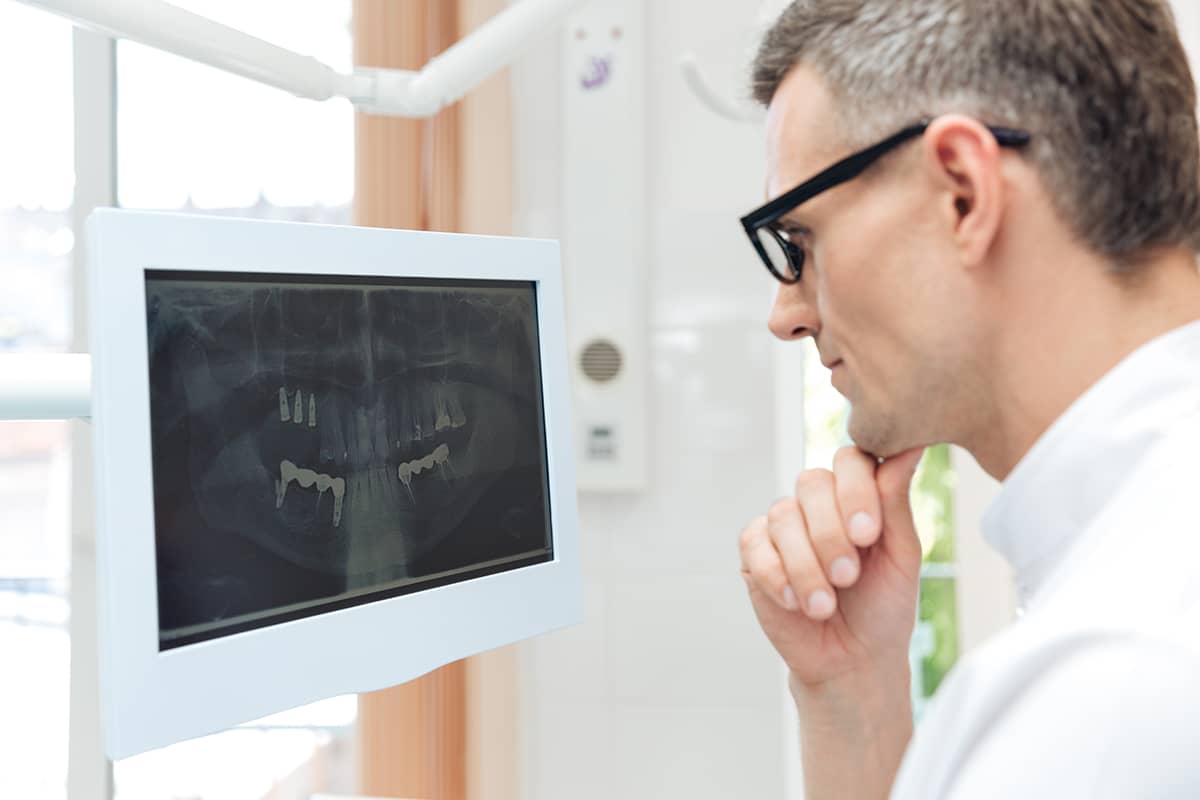 male dentist looking at teeth on digital xray monitor